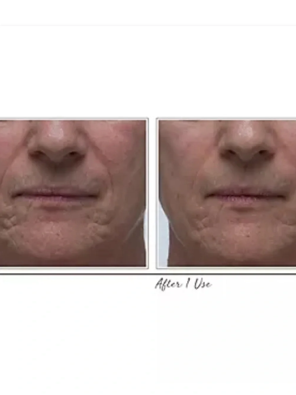 Dr. Denese Collagen Firming Peel Off Mask 4 oz